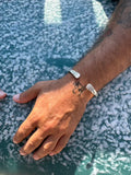Hand with multiple bracelets on a textured surface
