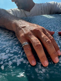 Hand with a ring on a textured surface, possibly ice or salt